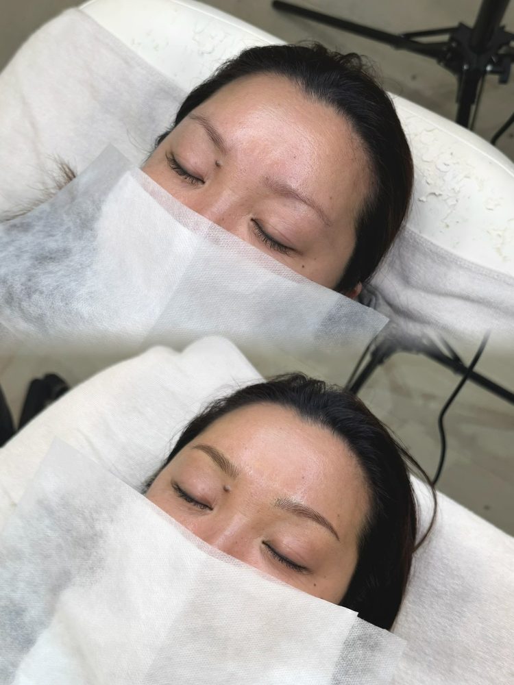 Before/After