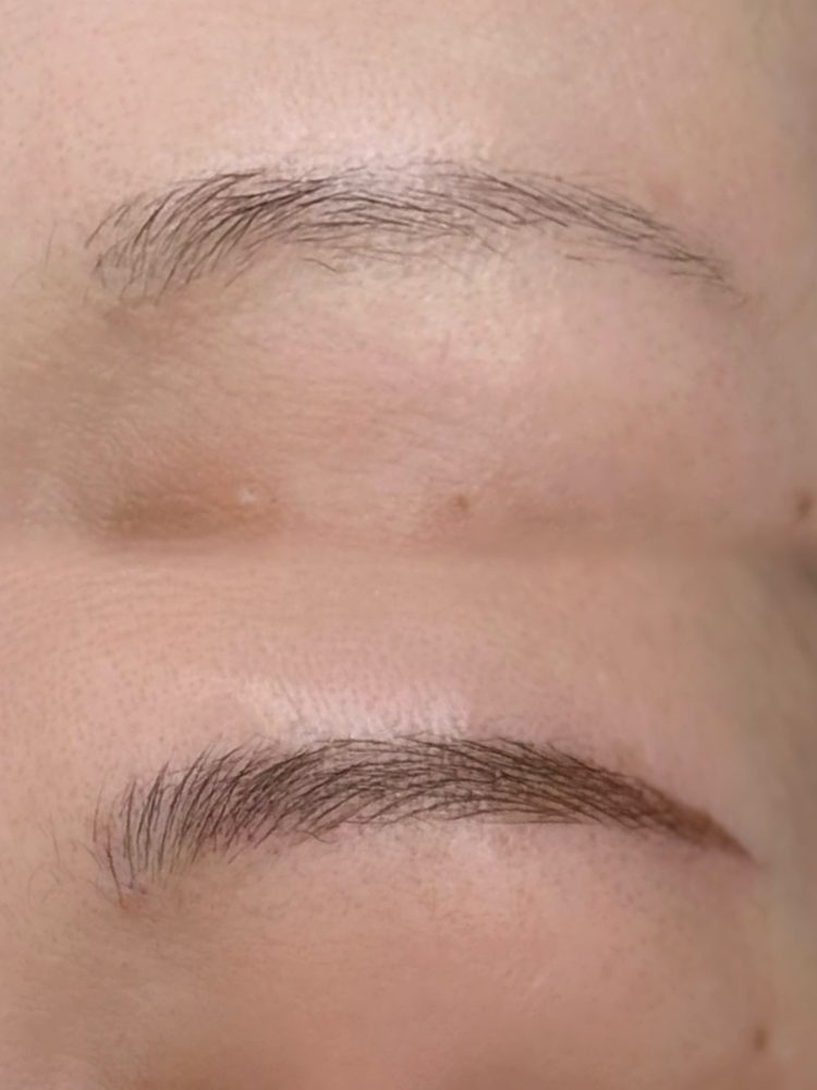 Before/After