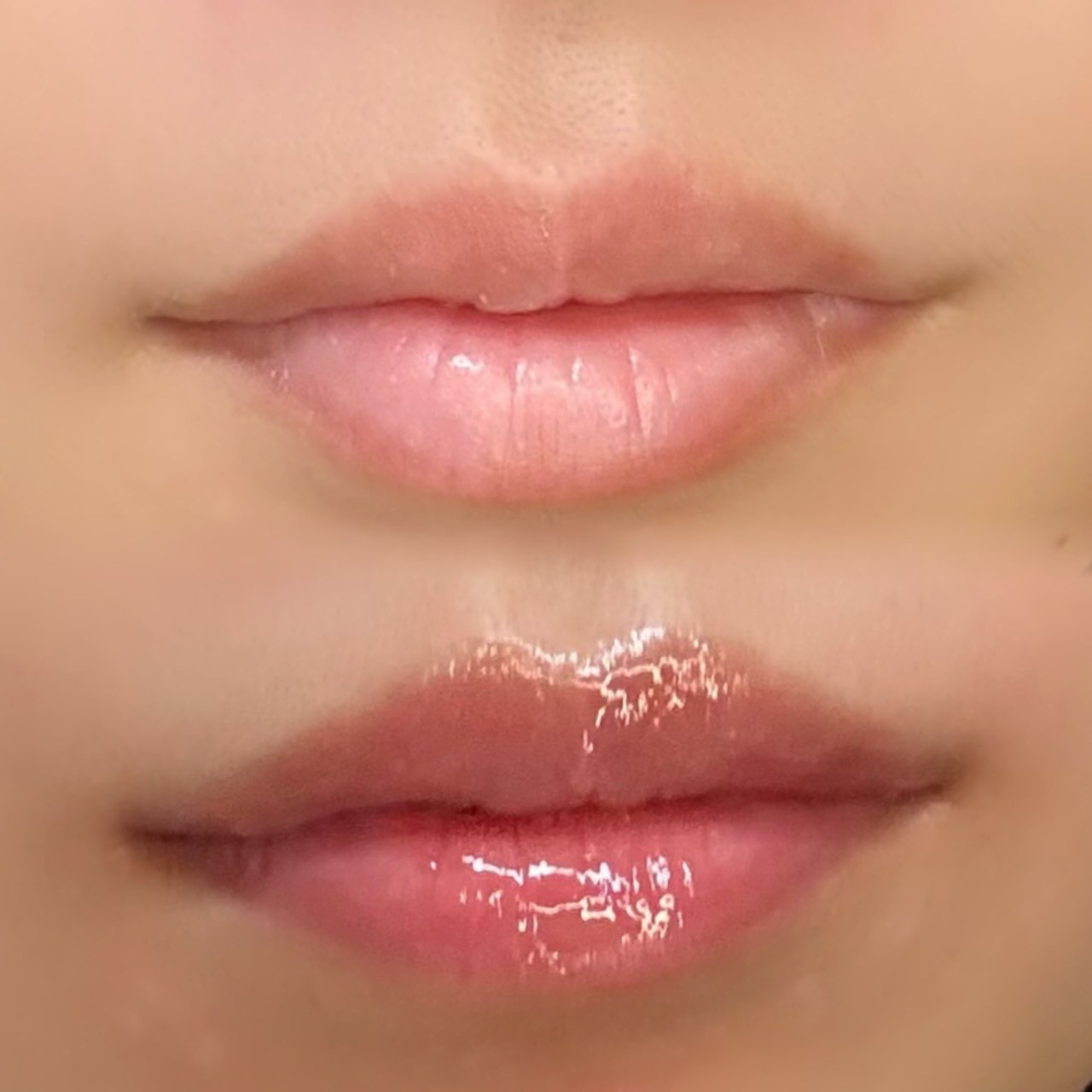 リップアートメイク症例1 - 上：Before / 下：After